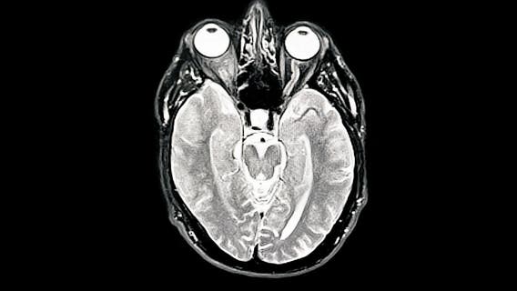 SuperAgers over 80 show memory equal to adults in their 50s, study finds