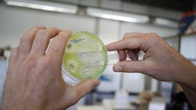 'Nightmare bacteria' cases on the rise in US, CDC report finds