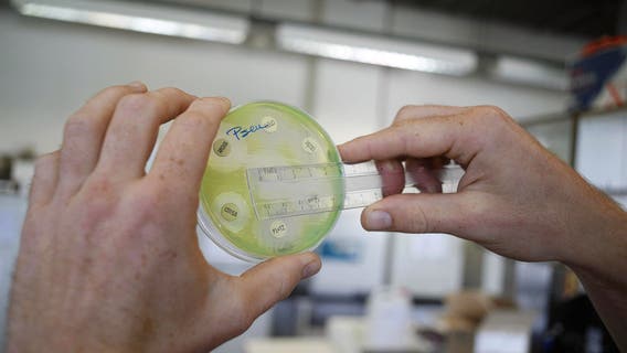 'Nightmare bacteria' cases on the rise in US, CDC report finds