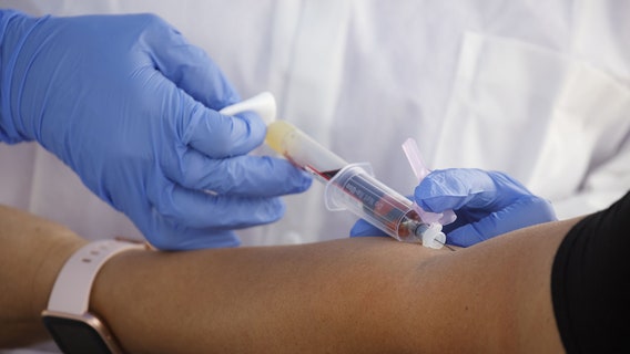 Prostate cancer - symptoms, risk factors, and treatment