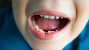FDA puts restrictions on fluoride use for kids