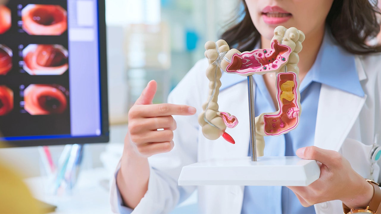 Colorectal cancer: Symptoms and what causes it