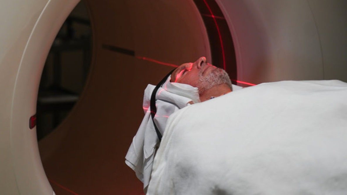 Exercise-boosted liver enzyme tied to Alzheimer’s protection, study finds