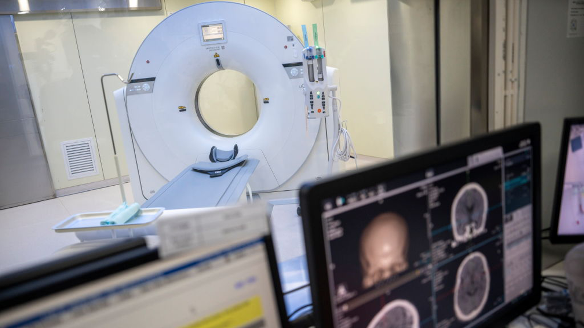 Advanced CTE tied to sharp rise in dementia risk, major brain study finds