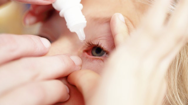 Pig semen eye drops may treat rare childhood eye cancer, study says