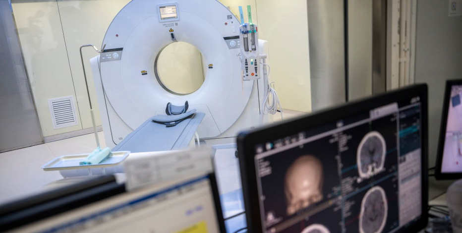 Advanced CTE tied to sharp rise in dementia risk, major brain study finds