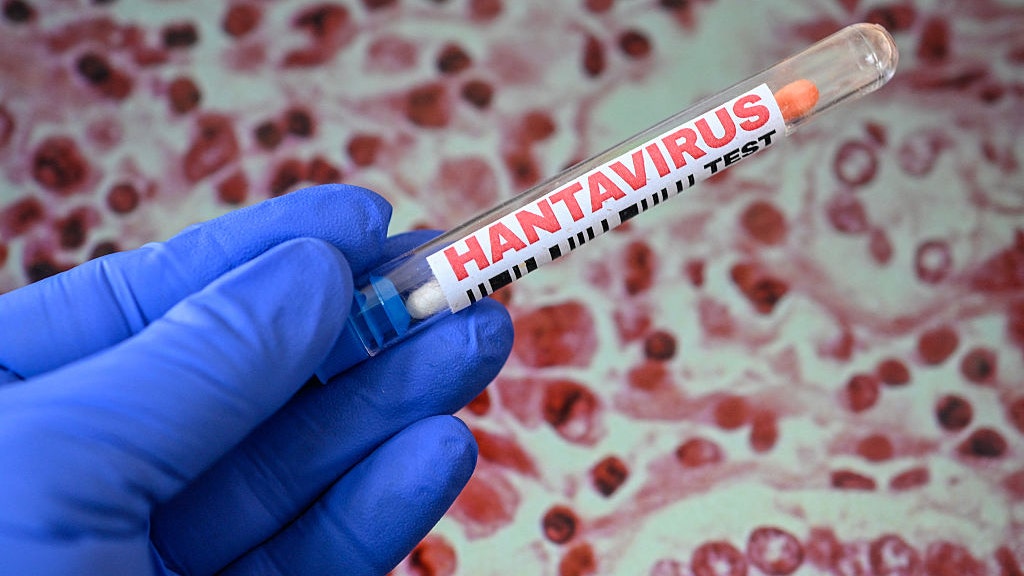 Colorado reports adult death linked to hantavirus