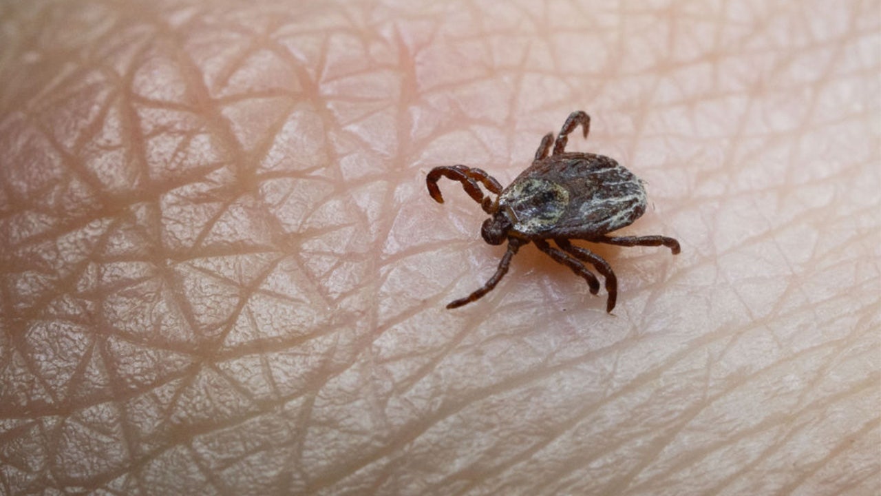 Tick bite ER visits hit highest seasonal level in years as doctors warn of disease surge