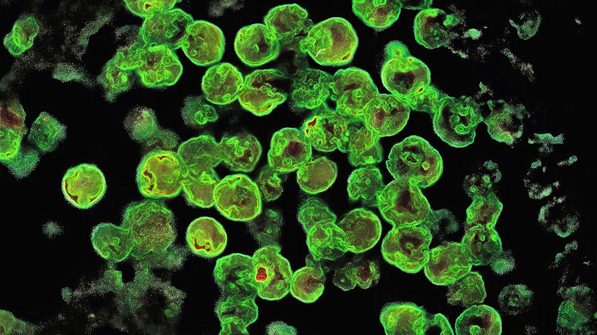 Brain-eating amoeba found in popular U.S. National Parks, including Yellowstone