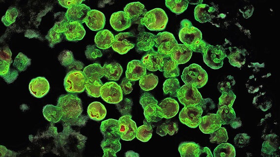 Brain-eating amoeba found in popular U.S. National Parks, including Yellowstone