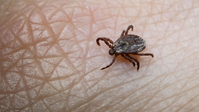 Tick bite ER visits hit highest seasonal level in years as doctors warn of disease surge