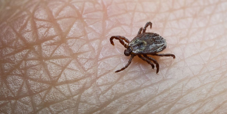 Tick bite ER visits hit highest seasonal level in years as doctors warn of disease surge
