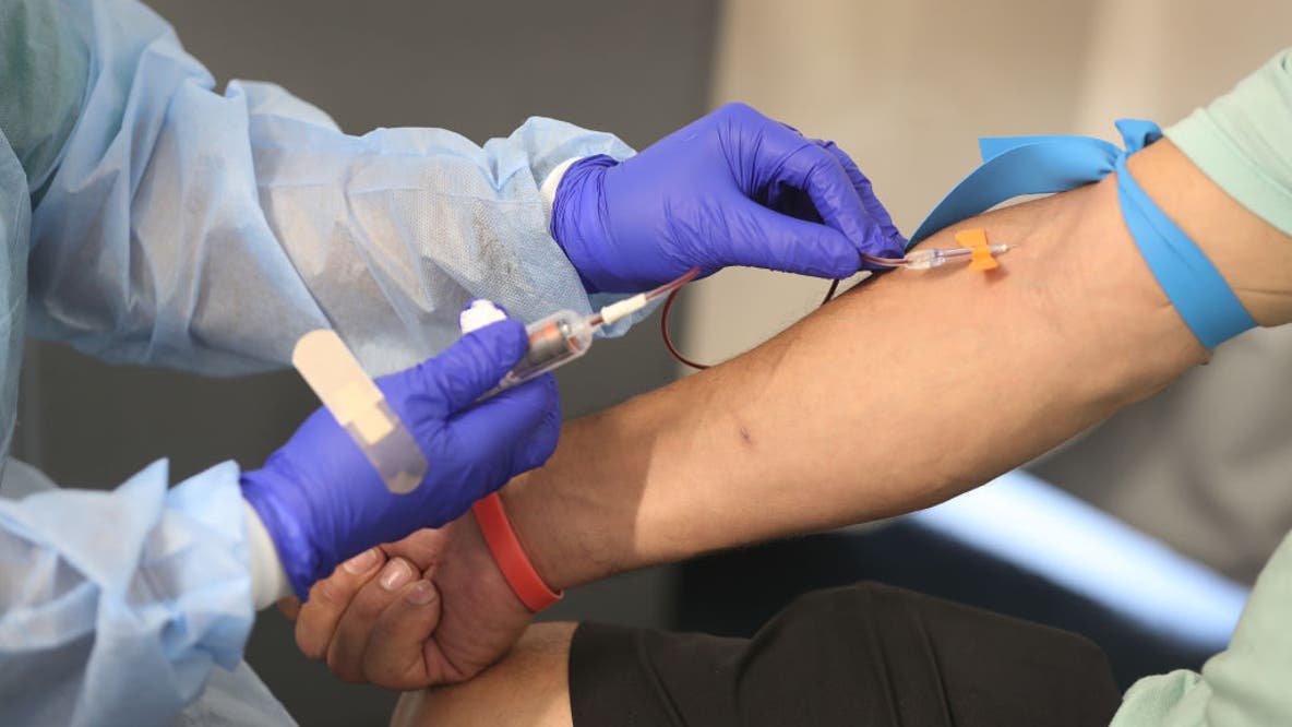 New blood test detects aggressive prostate cancer more accurately than PSA, study finds
