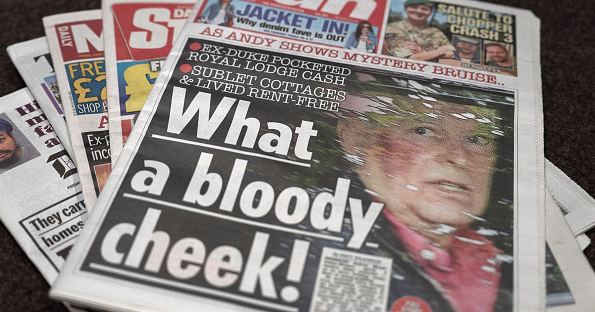 Former Prince Andrew spotted with bruise covering half his face as mystery injury sparks questions