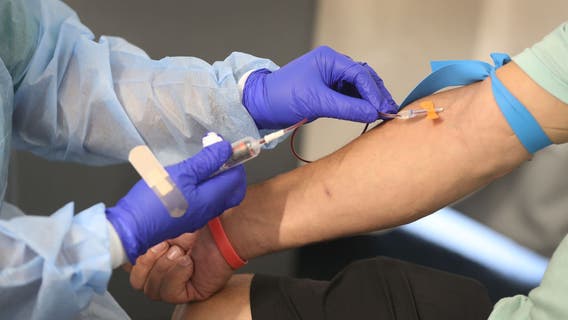 New blood test detects aggressive prostate cancer more accurately than PSA, study finds