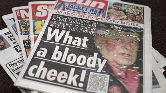 Former Prince Andrew spotted with bruise covering half his face as mystery injury sparks questions