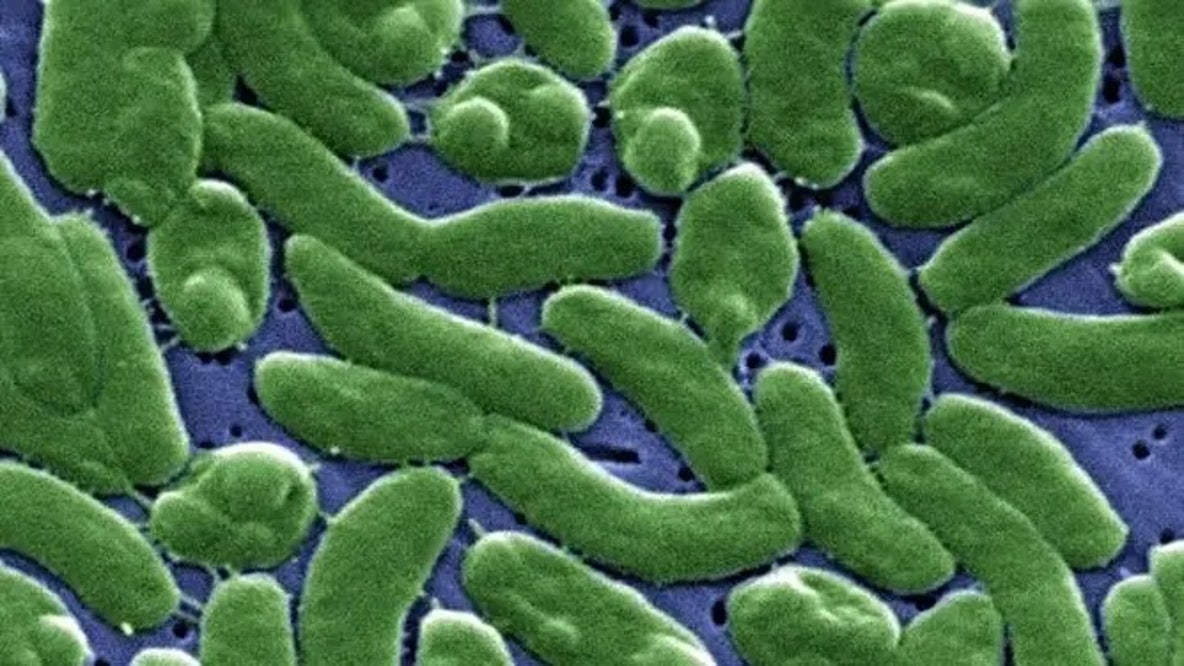 Case tracker: Here is where flesh-eating bacteria cases have been reported in the US