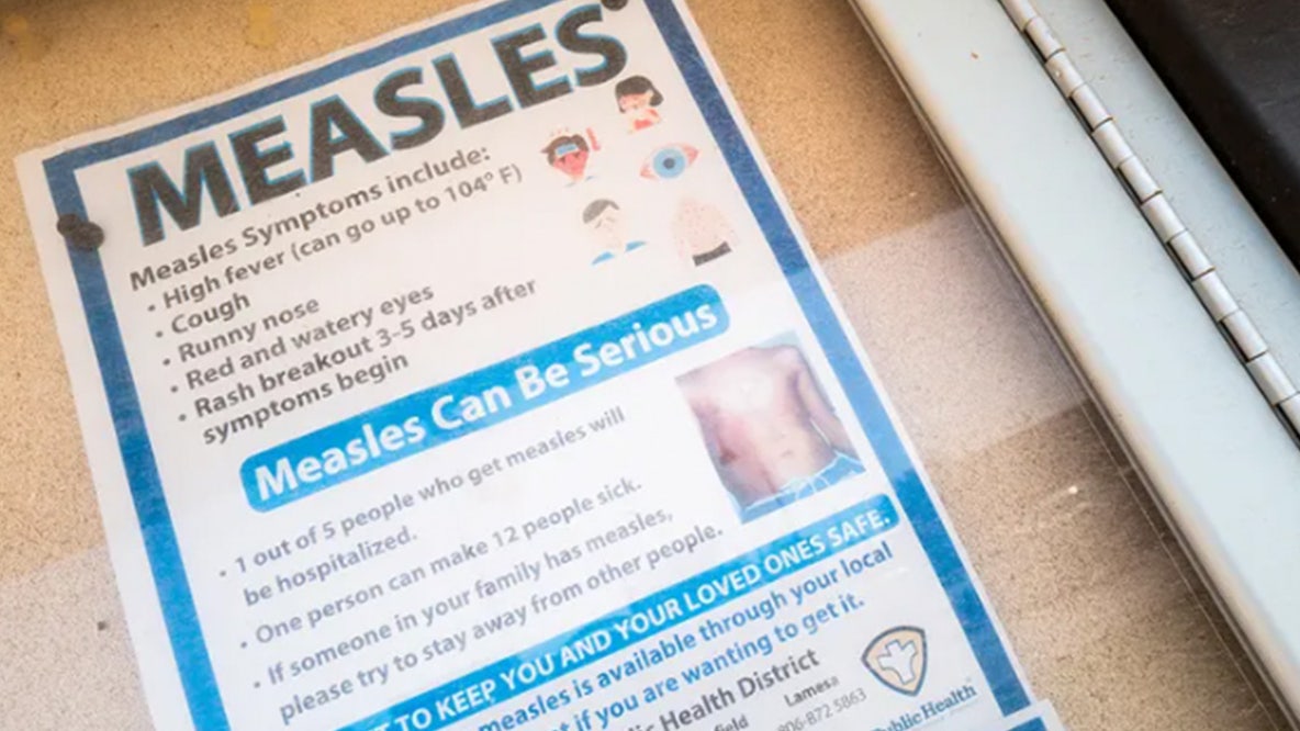 Measles surge hits new milestone as US cases surpass last year's total