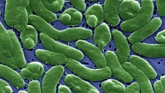 Case tracker: Here is where flesh-eating bacteria cases have been reported in the US