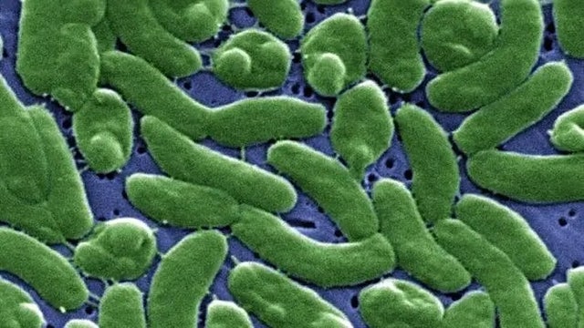 Case tracker: Here is where flesh-eating bacteria cases have been reported in the US
