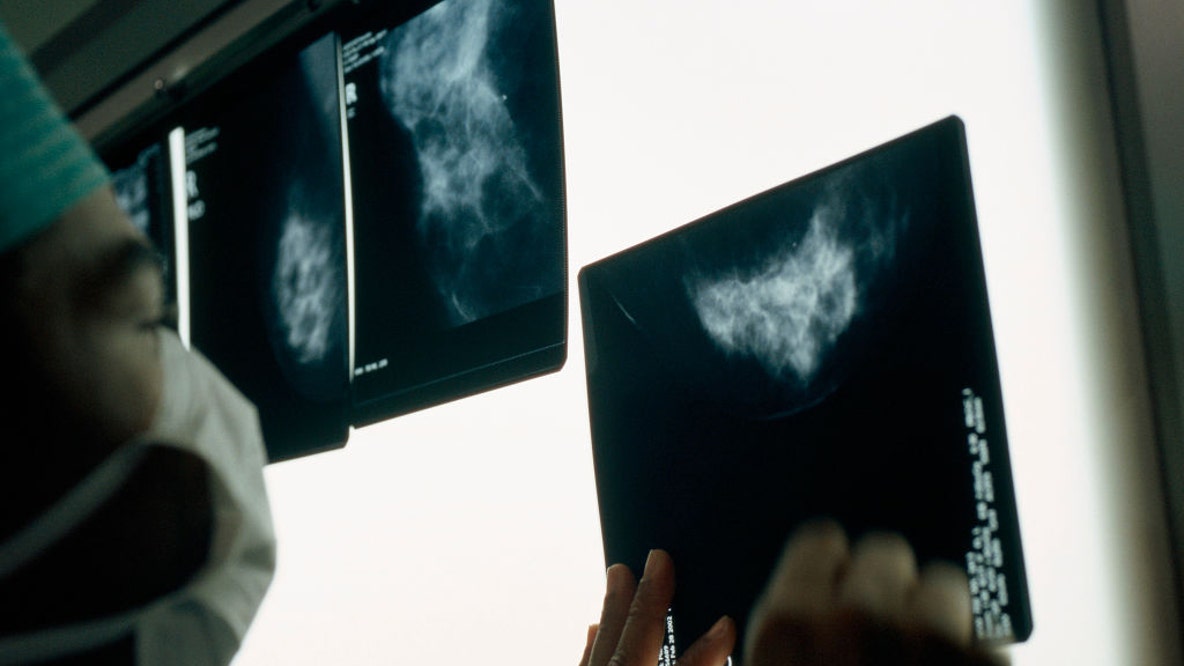 Vaccine could prevent some forms of colon cancer