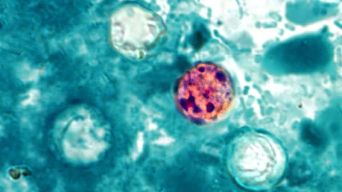 Lettuce-linked cyclosporiasis outbreak expands to 3 more states
