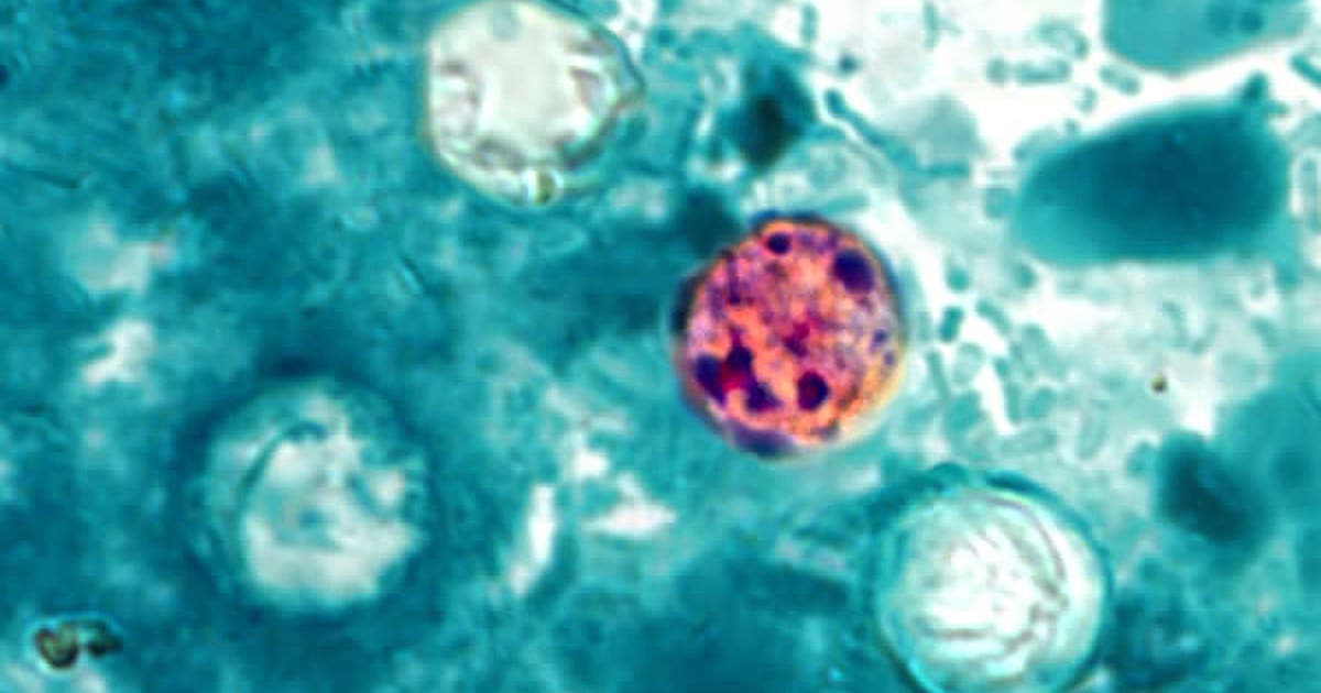 Lettuce-linked cyclosporiasis outbreak expands to 3 more states