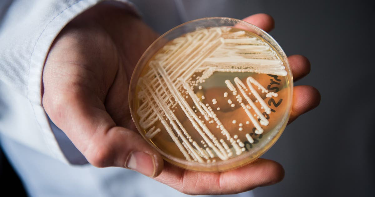 Candida auris, a drug-resistant fungus, is spreading again: What to know