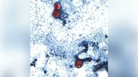Cyclospora research projects shuttered as US cases climb