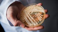 Candida auris, a drug-resistant fungus, is spreading again: What to know