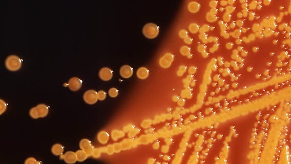 CDC links multistate E. coli and salmonella outbreak to alfalfa sprouts