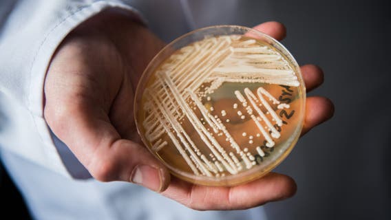 Candida auris, a drug-resistant fungus, is spreading again: What to know