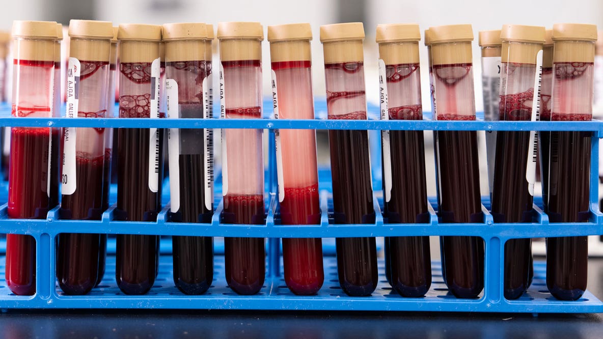 FDA-endorsed blood test can spot early signs of more than 50 types of cancer, drugmaker says