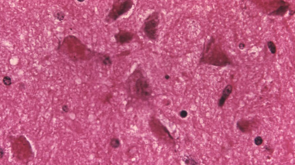 CDC warns of rise in animal rabies activity and human exposures: Here’s what to know