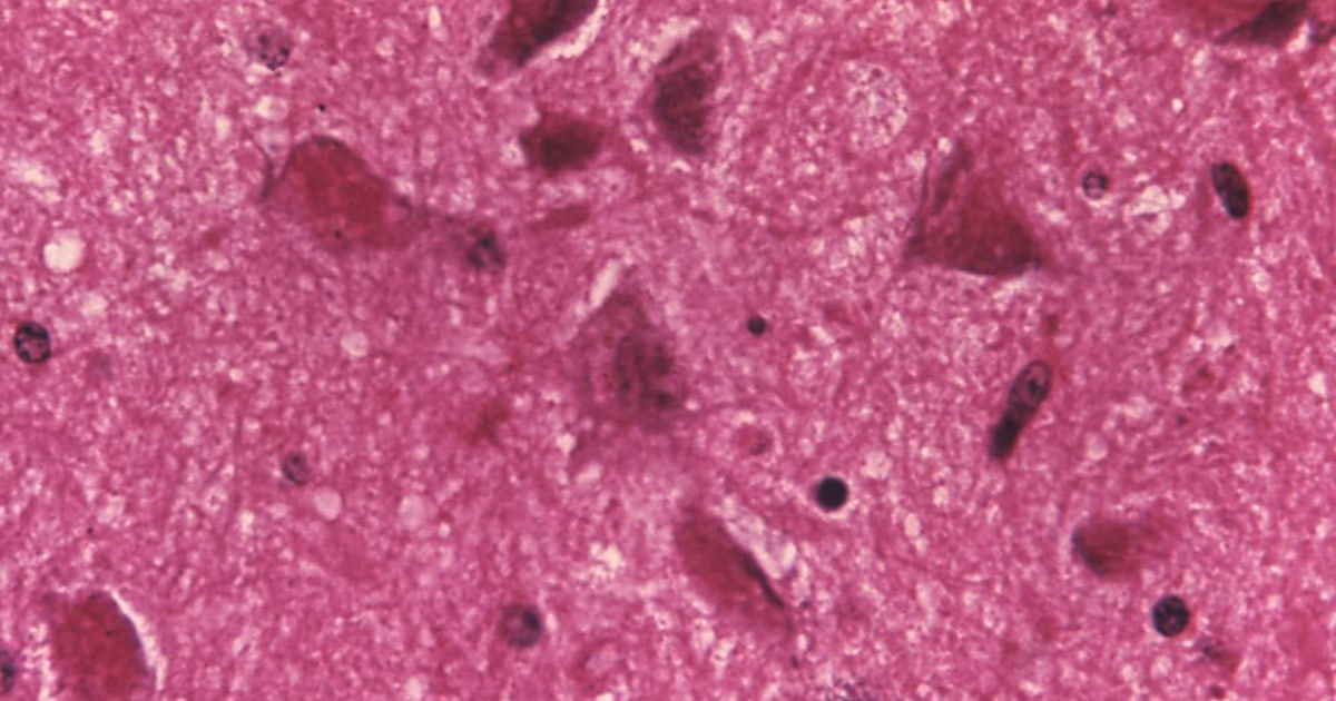 CDC warns of rise in animal rabies activity and human exposures: Here’s ...