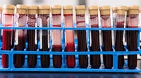FDA-endorsed blood test can spot early signs of more than 50 types of cancer, drugmaker says
