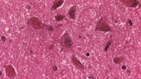 CDC warns of rise in animal rabies activity and human exposures: Here’s what to know