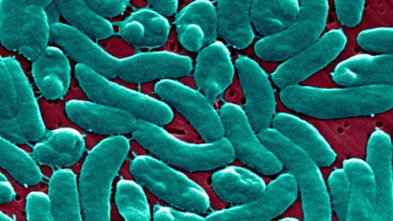 ‘Flesh-Eating’ bacteria cases reported across U.S. as Florida records another death