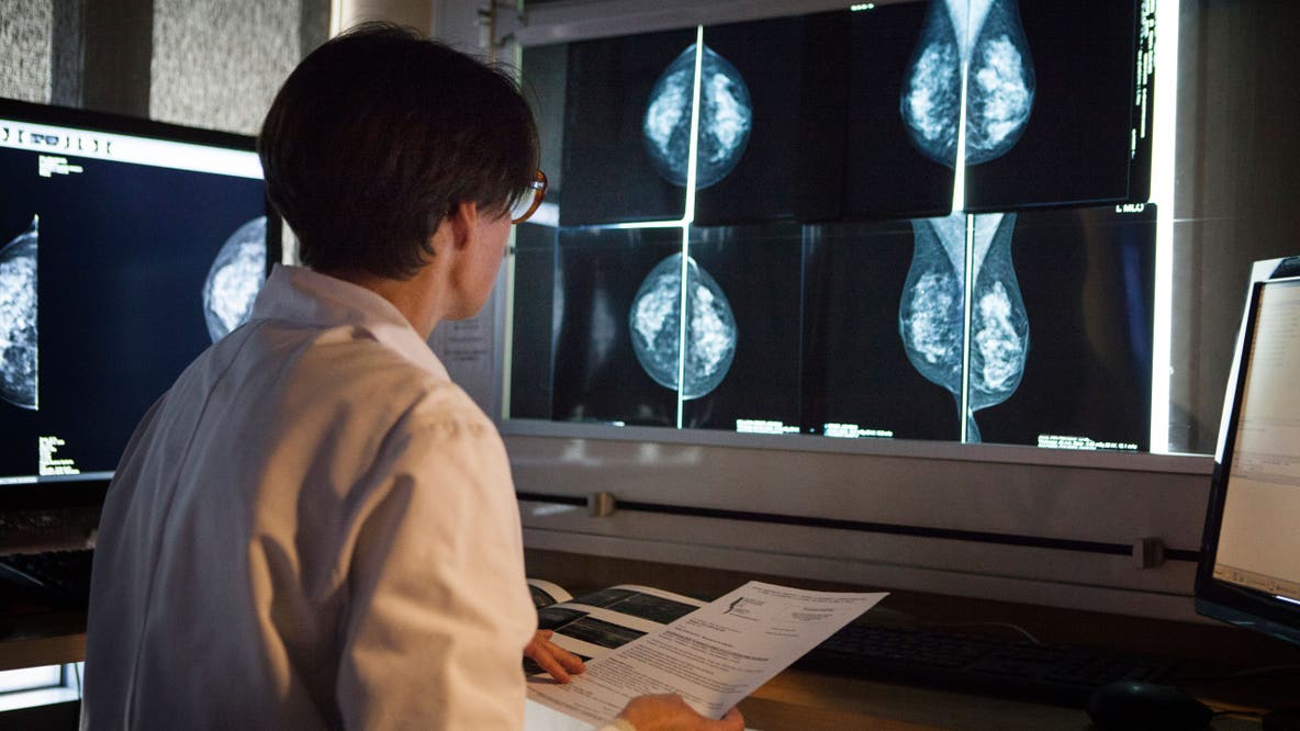 FDA clears use of AI tool designed to predict whether breast cancer will recur