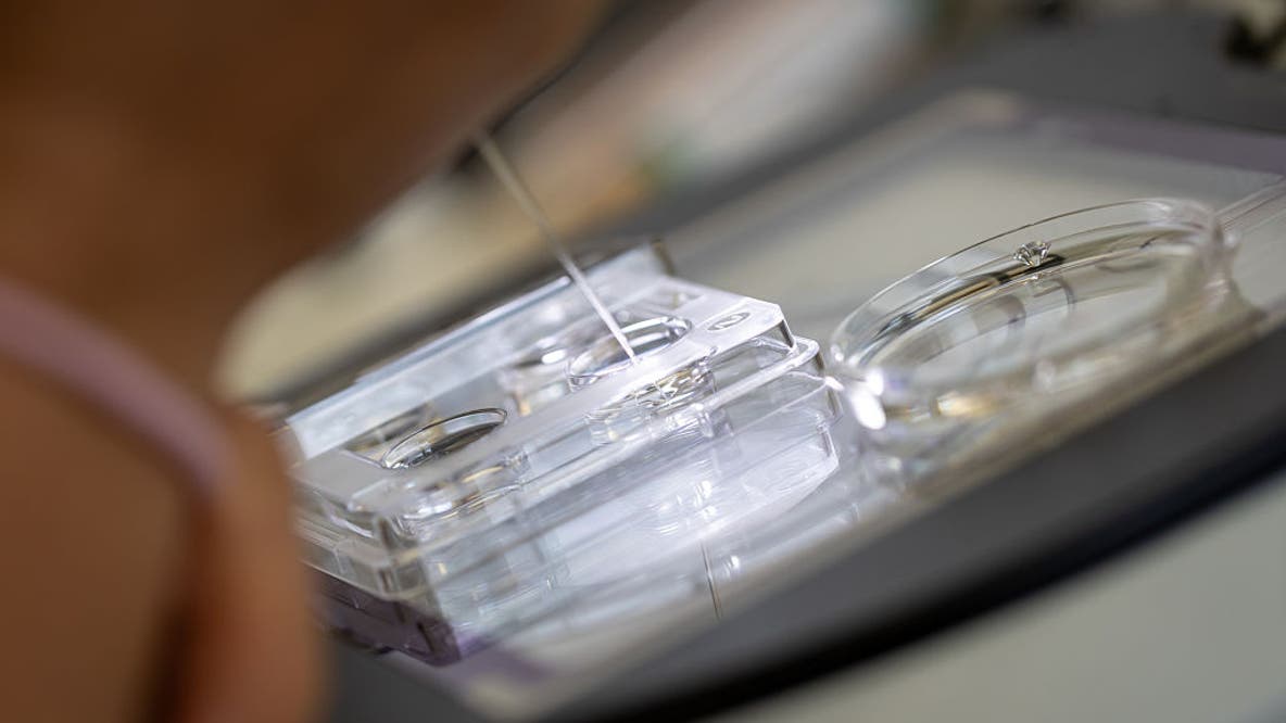 Childhood cancer risk may be higher after some fertility treatments, study finds