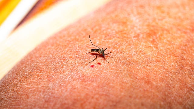 US sees worst Dengue Fever outbreak since the 1930s, experts say