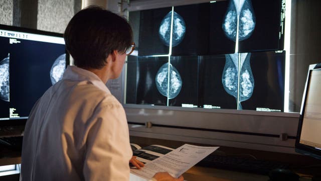 FDA clears use of AI tool designed to predict whether breast cancer will recur