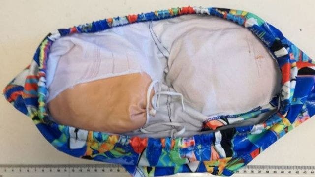 Drug smugglers tried using fake butt implants to hide cocaine, police say