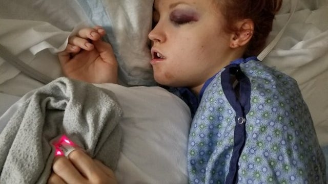 Selfless act during sledding accident saves three-year-old