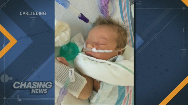 Baby defies death; has double lung transplant
