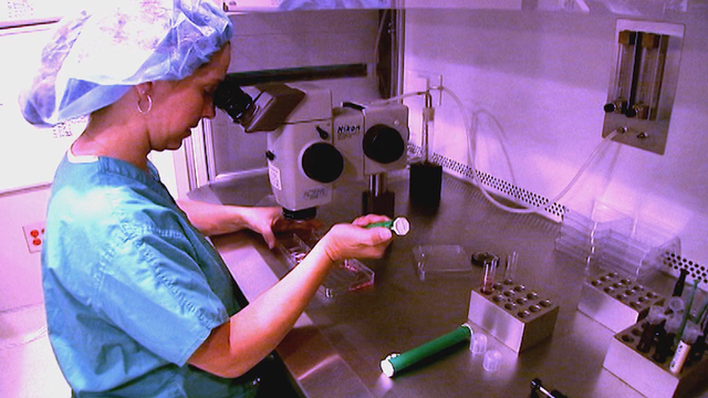 What you need to know about colon cancer