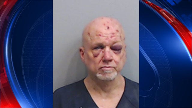 Charges upgraded against man accused of attacking delivery driver