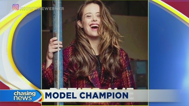 Special Olympics champion begins modeling