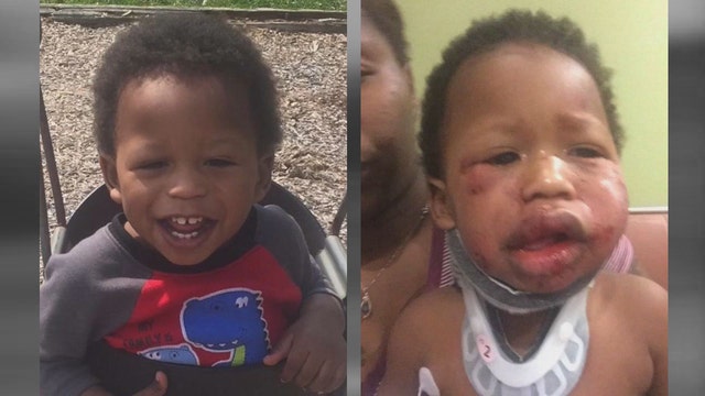 No charges in Indiana day care attack that hurt 1-year-old