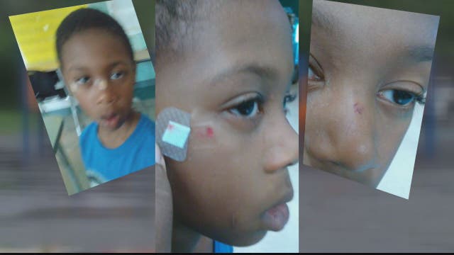 6-year-old DC boy attacked by another student's parent, mother says